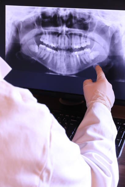Best Broken or Cracked Tooth Emergency Dentist in Silver Creek, NY
