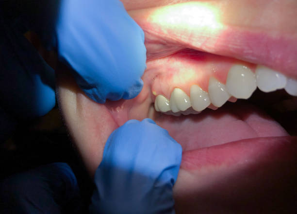 Best Emergency Cosmetic Dentistry in Silver Creek, NY