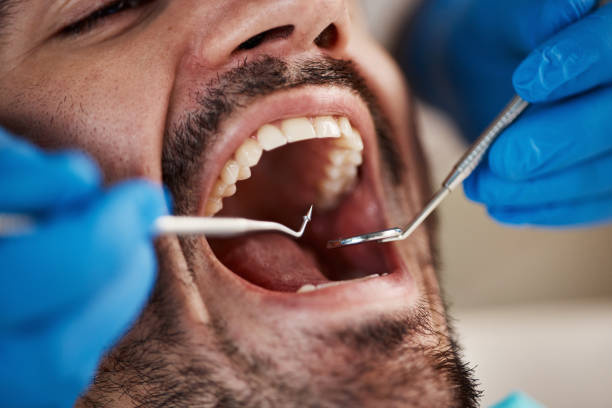 Best Pediatric Emergency Dentist in Silver Creek, NY